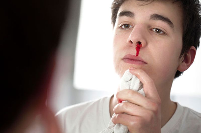 Sıcak havalarda burun kanamaları nedenlerine dikkat!