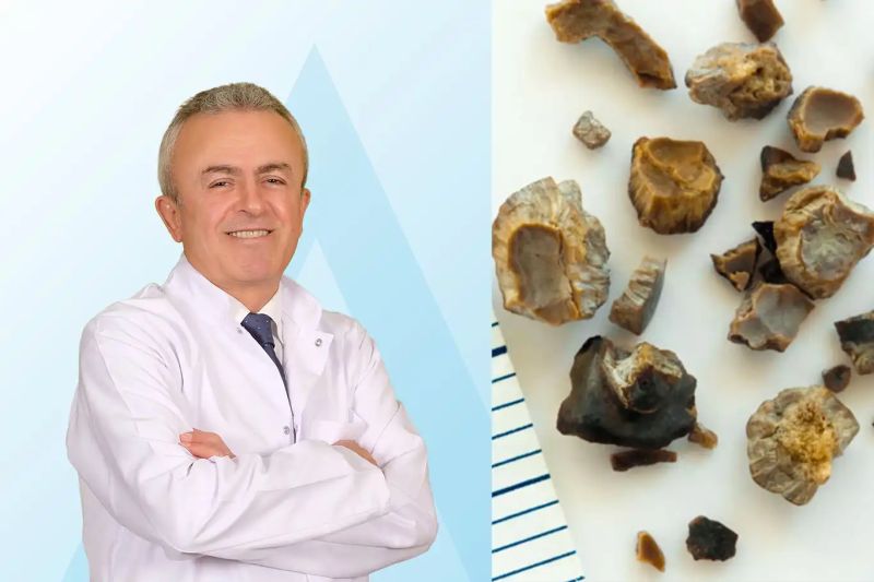 Prof. Dr. Tekin: Yetersiz su tüketimi böbrek taşına yol açabiliyor