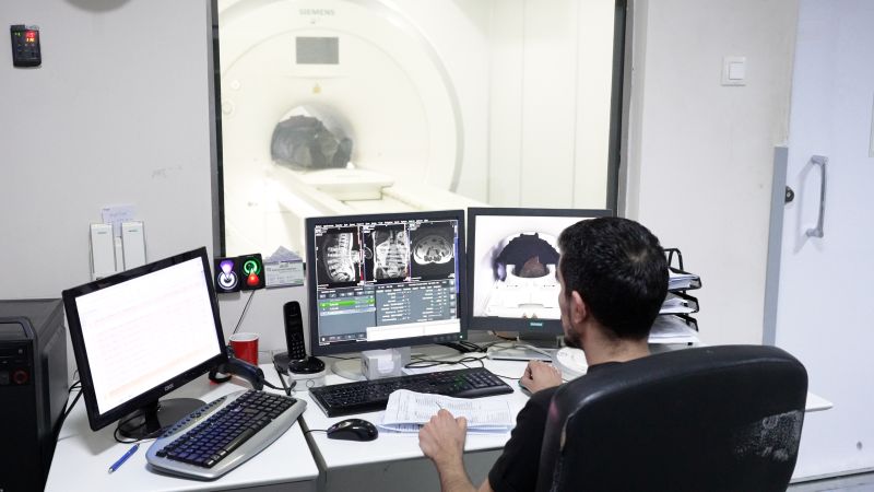 Malatya Eğitim ve Araştırma Hastanesi’nde İleri Görüntüleme Hamlesi