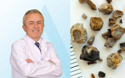 Prof. Dr. Tekin: Yetersiz su tüketimi böbrek taşına yol açabiliyor
