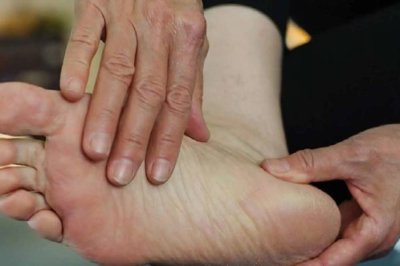 Diyabetlilere ayak yaraları için tavsiyeler