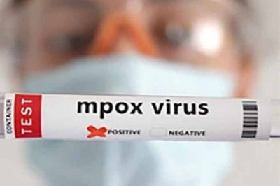 Pakistan'da maymun çiçeği vakalarında artış